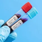 Carrier Screening Test